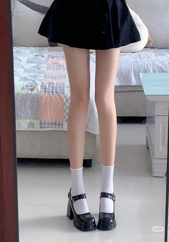 ‘漫画腿’膝关节外翻,医学上叫X型腿