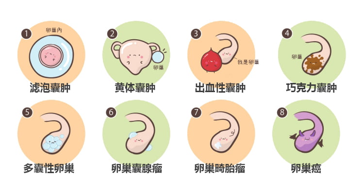 常见的8类卵巢囊肿