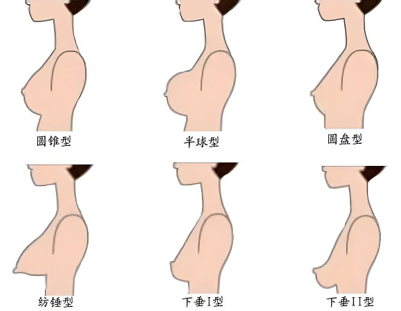 女性胸形图解