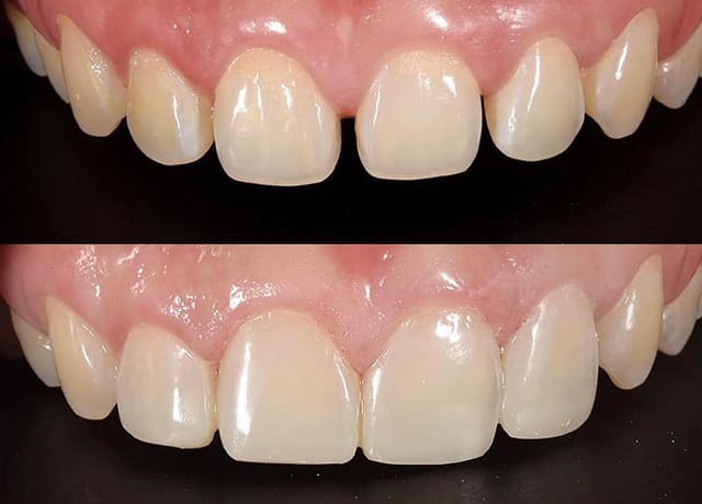 矫正前后的对比示意图