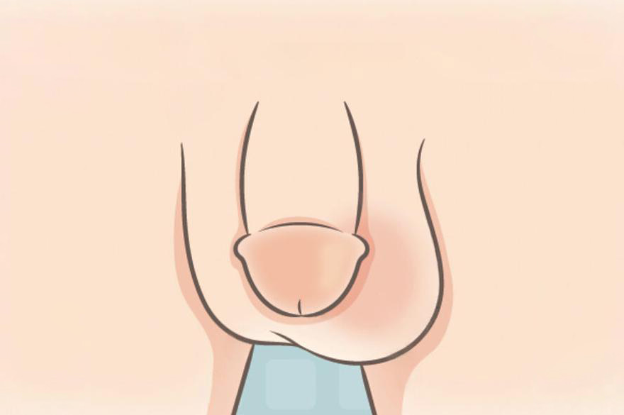 男性睾丸大小差异示意图