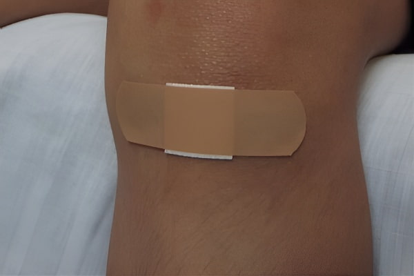 梦中伤口流血的象征含义